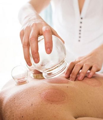 Cupping Massage Therapy